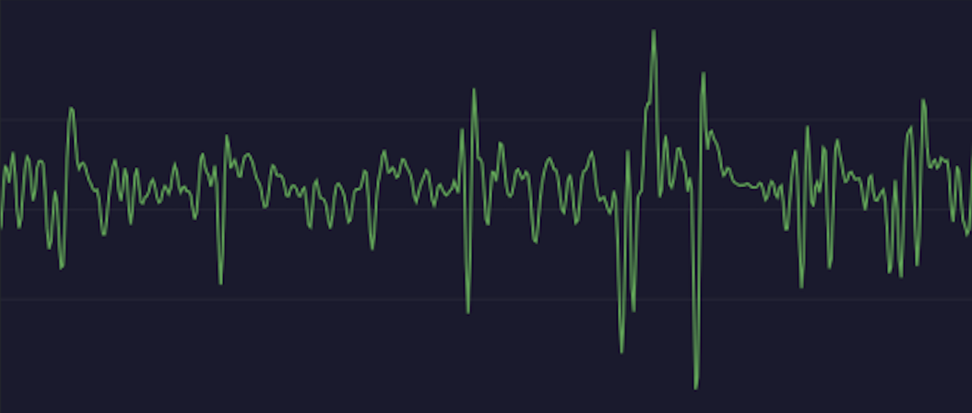 Ear ECG signal